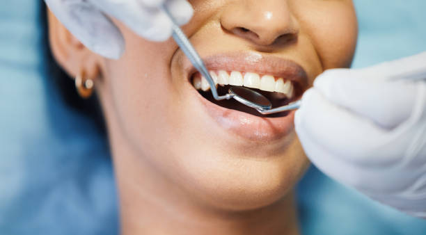 Best Emergency Tooth Extraction in Central City, IL