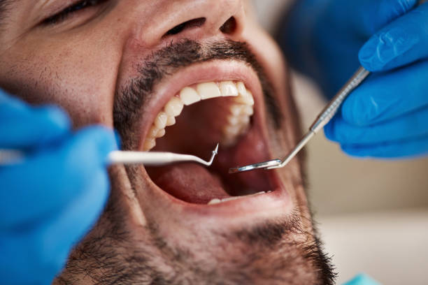 Best Same-Day Emergency Dental Services in Central City, IL